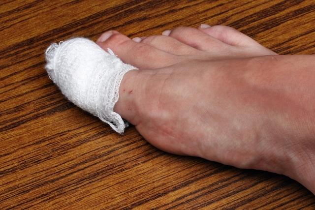 Unha Encravada? Unha Encravada?