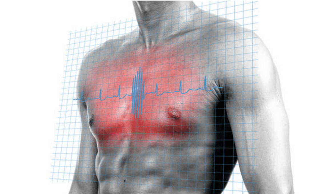 Dor no peito o que pode ser Dor no peito o que pode ser